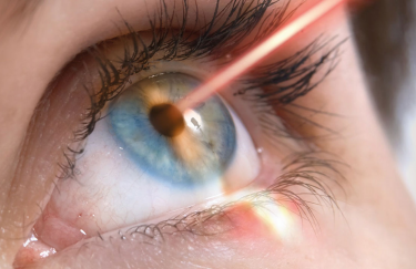 Лазерна корекція зору: повний гід до кришталево чіткого погляду