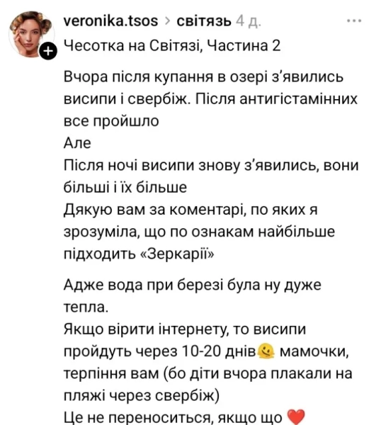 Шкірний висип на Шацьких озерах: розкриваємо причини роздратування на популярному курорті 9