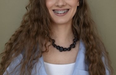 Скільки потрібно носити металеві брекети для досягнення результату Скільки потрібно носити металеві брекети для досягнення результату